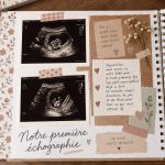 Femme enceinte se rendant à sa première échographie